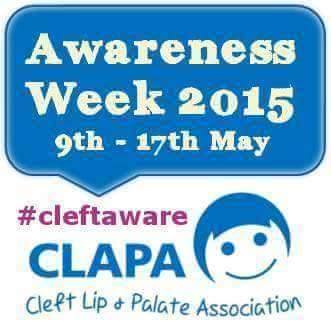 Frankie’s Cleft Lip & Palate Story: Cleft Lip & Palate Awareness Week 2015
